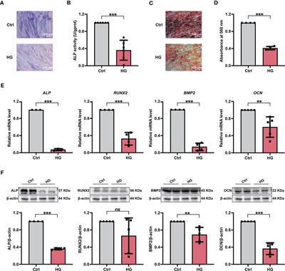 NADPH-dependent ROS accumulation contributes to the impaired osteogenic differentiation of periodontal ligament stem cells under high glucose conditions